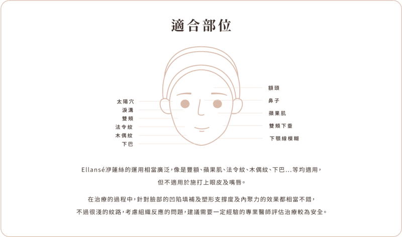 洢蓮絲少女針 適合部位