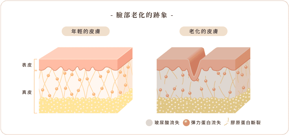 自體脂肪補臉 肌膚老化圖