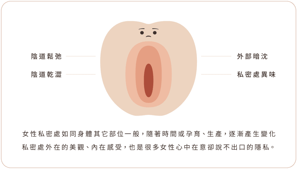 私密處保養 手機版 困擾