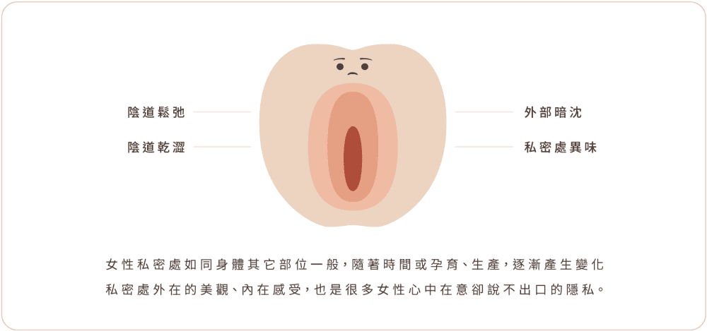 私密處保養 私密處困擾