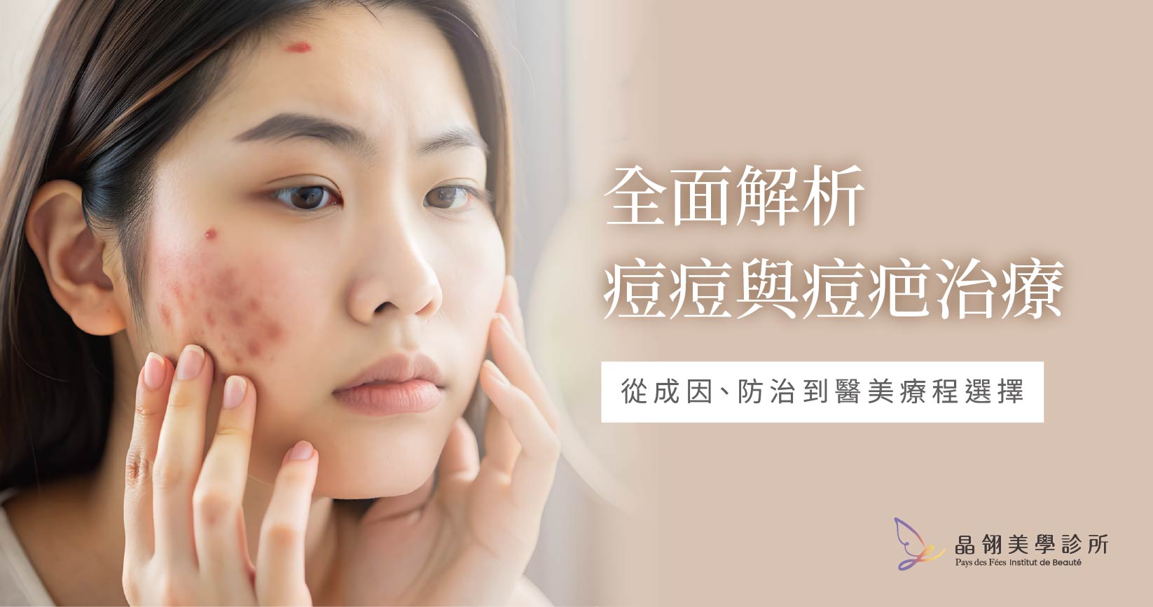 全面解析痘痘與痘疤治療：從成因、防治到醫美療程選擇
