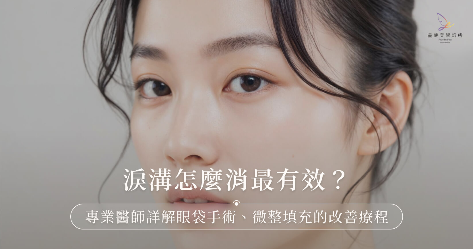 淚溝怎麼消最有效？專業醫師詳解眼袋手術、微整填充的改善療程