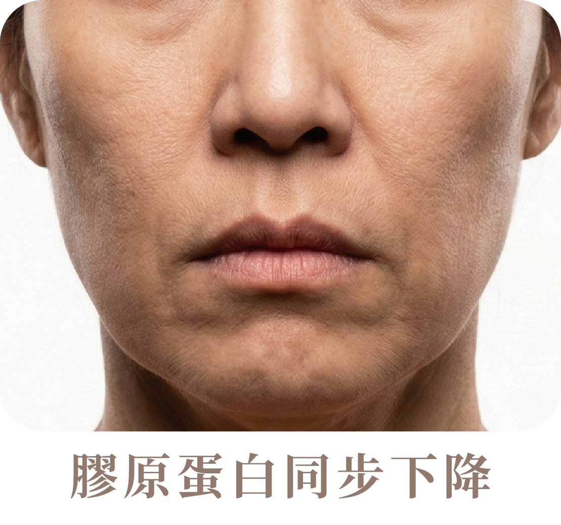 猛健樂臉是什麼?臉凹、臉垮解析-09.png