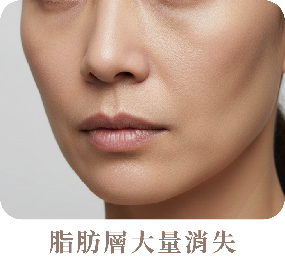 猛健樂臉是什麼?臉凹、臉垮解析-05.png
