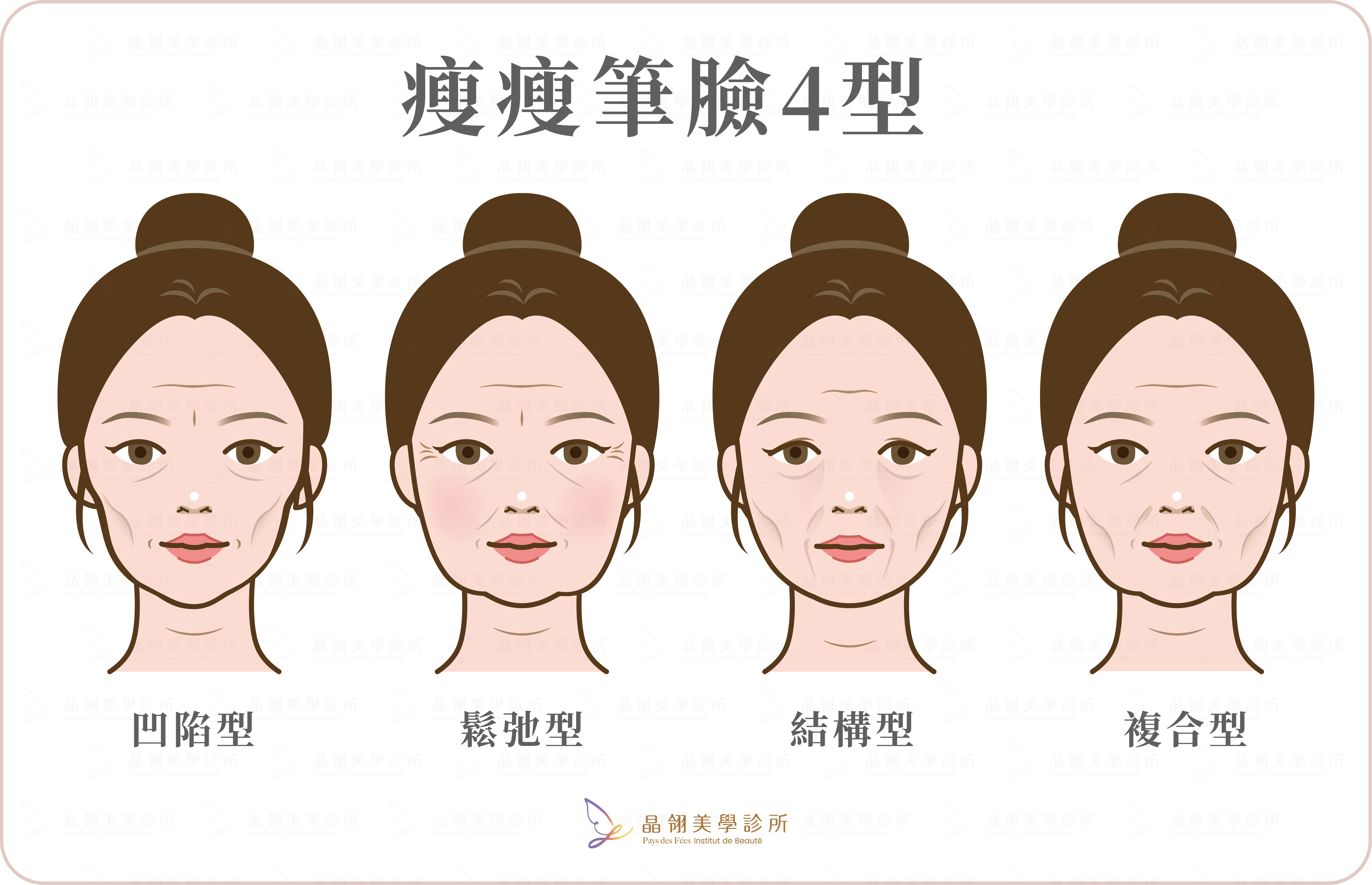 猛健樂臉是什麼?臉凹、臉垮解析-11.png