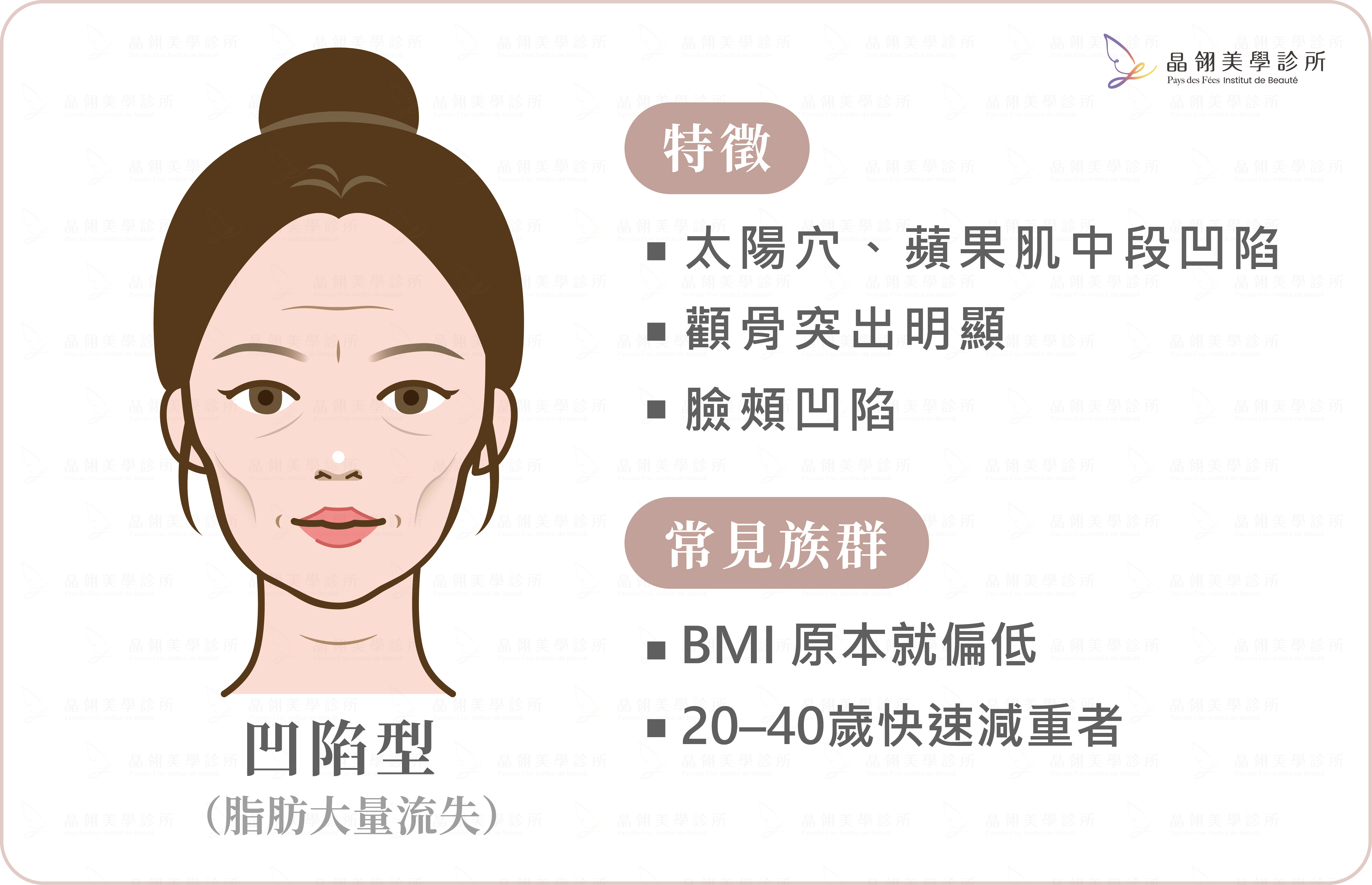 猛健樂臉是什麼?臉凹、臉垮解析-14.png