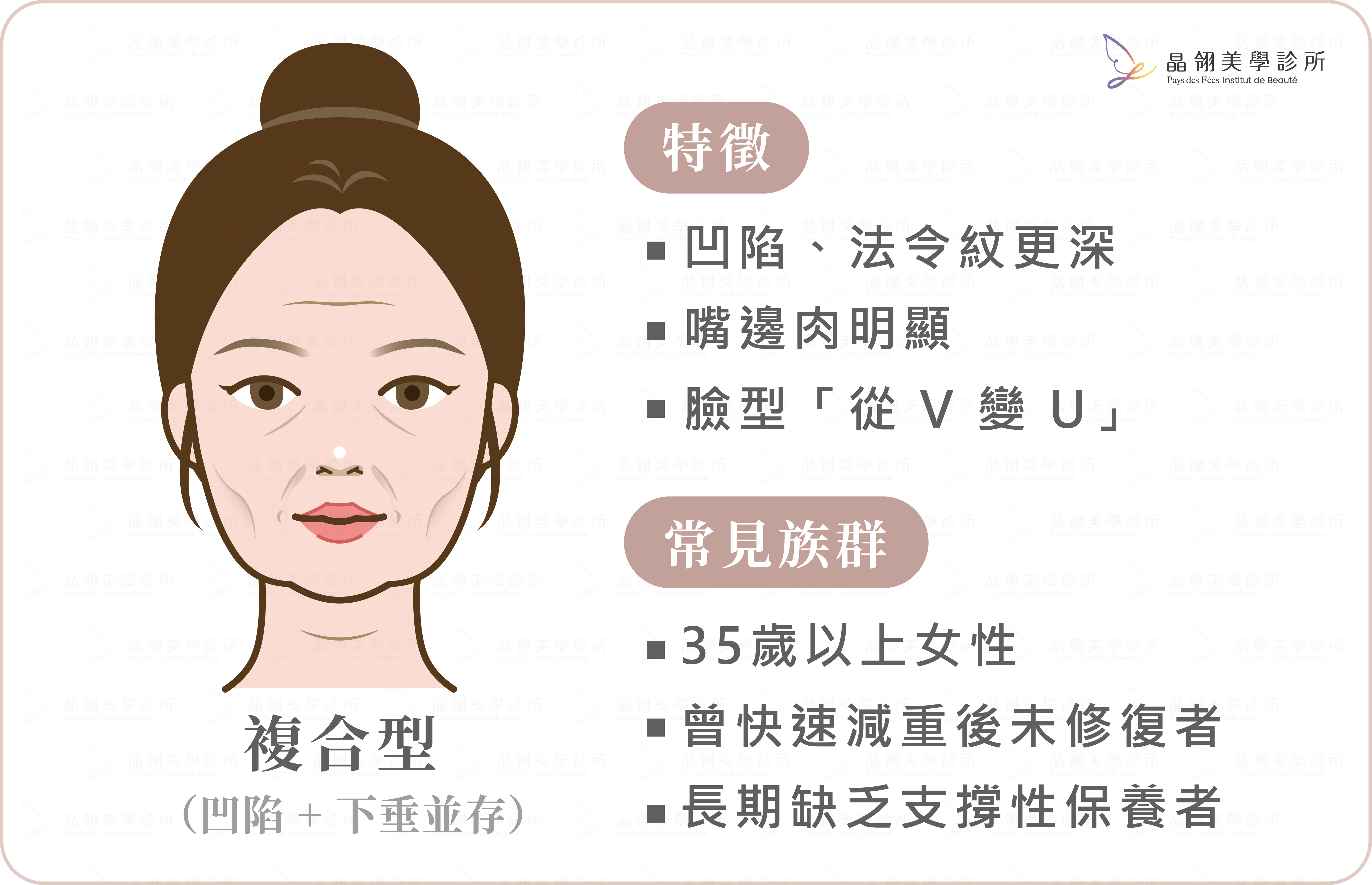 猛健樂臉是什麼?臉凹、臉垮解析-13.png