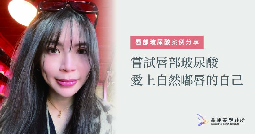 【唇部玻尿酸案例】愛上自然嘟唇的自己,Kysse 唇玻尿酸分享_工作區域 1.jpg