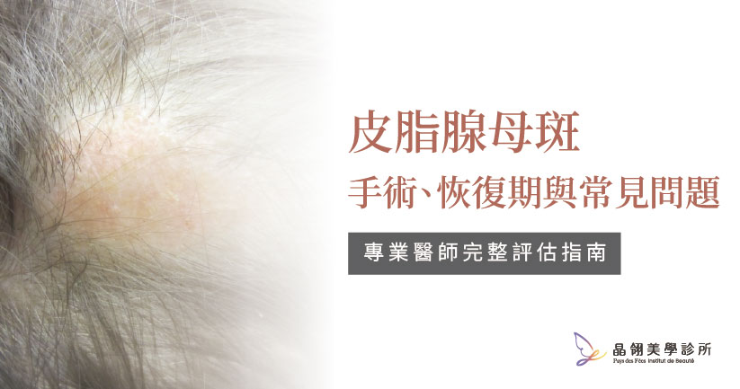 皮脂腺母斑是什麼？從成因、治療方式到手術時機完整解析