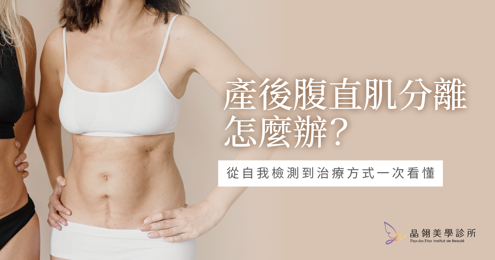 【2026全攻略】腹直肌分離怎麼辦？從自我檢測到專業治療，找回平坦小腹！